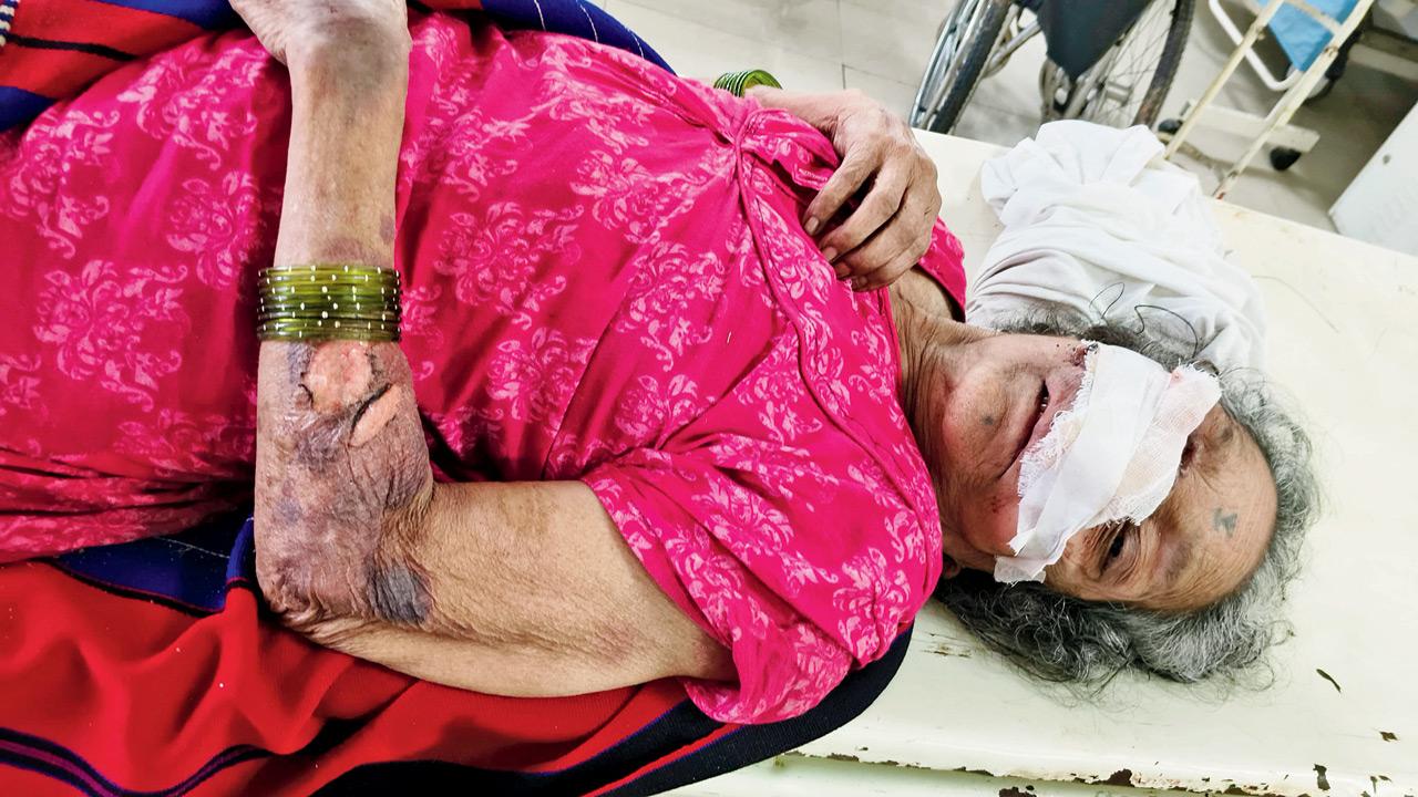Nagpur cancer hospital offers ‘dumped’ granny free treatment
